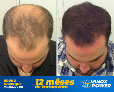 Bruno - MinoxPower Bruno - MinoxPower