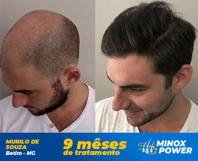 Murilo - MinoxPower Murilo - MinoxPower