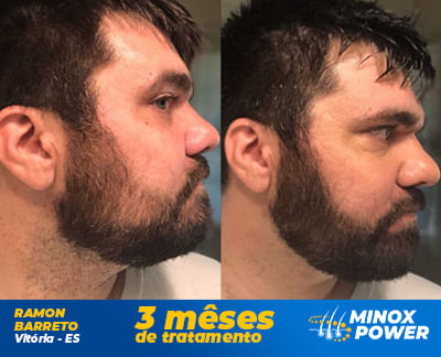 Ramon - MinoxPower Ramon - MinoxPower