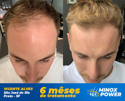 Vicente Alves - MinoxPower Vicente Alves - MinoxPower